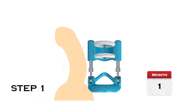 Premium Penis Pro Stretching Device Penis Pro Extender for Personal Wellness