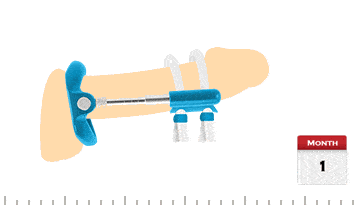 Comfortable Daily Wear Penis Extender Penis Pro Extender with Flexible Adjustment